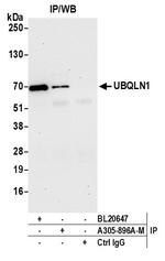 UBQLN1 Antibody in Immunoprecipitation (IP)