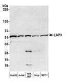 LAP3 Antibody in Western Blot (WB)