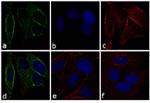 Mouse IgG (H+L) Secondary Antibody in Immunocytochemistry (ICC/IF)