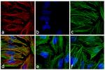 Mouse IgG (H+L) Highly Cross-Adsorbed Secondary Antibody in Immunocytochemistry (ICC/IF)