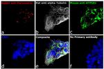 Mouse IgG (H+L) Highly Cross-Adsorbed Secondary Antibody in Immunocytochemistry (ICC/IF)