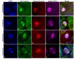 Mouse IgG (H+L) Highly Cross-Adsorbed Secondary Antibody in Immunocytochemistry (ICC/IF)