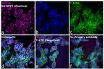 Mouse IgG (H+L) Highly Cross-Adsorbed Secondary Antibody in Immunocytochemistry (ICC/IF)