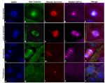 Rabbit IgG (H+L) Highly Cross-Adsorbed Secondary Antibody in Immunocytochemistry (ICC/IF)