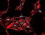 Rabbit IgG (H+L) Highly Cross-Adsorbed Secondary Antibody in Immunocytochemistry (ICC/IF)