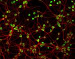 Rabbit IgG (H+L) Highly Cross-Adsorbed Secondary Antibody in Immunocytochemistry (ICC/IF)