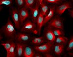 Goat IgG (H+L) Highly Cross-Adsorbed Secondary Antibody in Immunocytochemistry (ICC/IF)