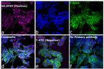 Mouse IgG (H+L) Highly Cross-Adsorbed Secondary Antibody in Immunocytochemistry (ICC/IF)