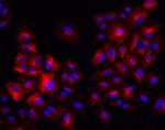 Rabbit IgG (H+L) Highly Cross-Adsorbed Secondary Antibody in Immunocytochemistry (ICC/IF)