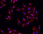 Goat IgG (H+L) Highly Cross-Adsorbed Secondary Antibody in Immunocytochemistry (ICC/IF)
