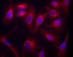 Goat IgG (H+L) Highly Cross-Adsorbed Secondary Antibody in Immunocytochemistry (ICC/IF)