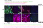 Human IgG (H+L) Cross-Adsorbed Secondary Antibody in Immunocytochemistry (ICC/IF)