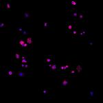 Human IgG (H+L) Cross-Adsorbed Secondary Antibody in Immunocytochemistry (ICC/IF)