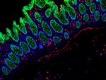 Mouse IgG (H+L) Cross-Adsorbed Secondary Antibody in Immunohistochemistry (Paraffin) (IHC (P))