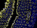 Mouse IgG (H+L) Cross-Adsorbed Secondary Antibody in Immunohistochemistry (Paraffin) (IHC (P))