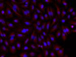 Mouse IgG (H+L) Cross-Adsorbed Secondary Antibody in Immunocytochemistry (ICC/IF)