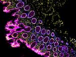 Mouse IgG (H+L) Cross-Adsorbed Secondary Antibody in Immunohistochemistry (Paraffin) (IHC (P))