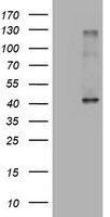 A4GNT Antibody in Western Blot (WB)