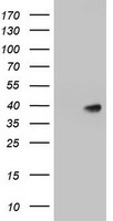 A4GNT Antibody in Western Blot (WB)