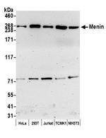 Menin Antibody in Western Blot (WB)