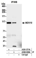 MOV10 Antibody in Immunoprecipitation (IP)