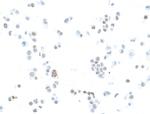 Estrogen Receptor Alpha Antibody in Immunocytochemistry (ICC/IF)