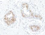 Estrogen Receptor Alpha Antibody in Immunohistochemistry (Paraffin) (IHC (P))