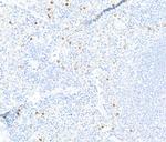 Ly-6G Antibody in Immunohistochemistry (IHC)