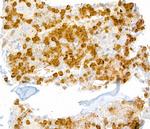 Ly-6G Antibody in Immunohistochemistry (IHC)