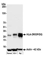 HLA-DR/DP/DQ Antibody in Western Blot (WB)