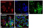 Human IgG (H+L) Secondary Antibody in Immunocytochemistry (ICC/IF)