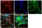 Human IgG (H+L) Secondary Antibody in Immunocytochemistry (ICC/IF)