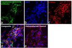 Human IgG (H+L) Secondary Antibody in Immunocytochemistry (ICC/IF)