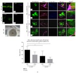 Synapsin 1 Antibody in Immunocytochemistry (ICC/IF)