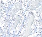 HIF2-alpha Antibody in Immunohistochemistry (IHC)