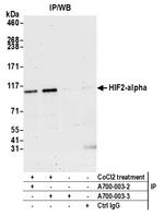 HIF2-alpha Antibody in Immunoprecipitation (IP)