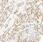 BRD4 Antibody in Immunohistochemistry (Paraffin) (IHC (P))