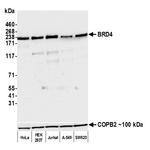 BRD4 Antibody in Western Blot (WB)