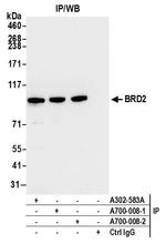 BRD2 Antibody in Immunoprecipitation (IP)