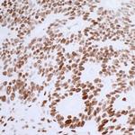 53BP1 Antibody in Immunohistochemistry (IHC)