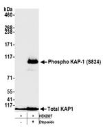 Phospho-KAP-1 (Ser824) Antibody in Western Blot (WB)