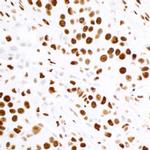 KAP-1 Antibody in Immunohistochemistry (Paraffin) (IHC (P))