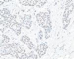 PBRM1 Antibody in Immunohistochemistry (Paraffin) (IHC (P))