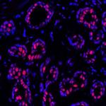 PBRM1 Antibody in Immunohistochemistry (Paraffin) (IHC (P))