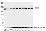 PBRM1 Antibody in Western Blot (WB)