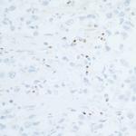 CD86 Antibody in Immunohistochemistry (Paraffin) (IHC (P))