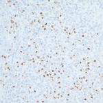 CD86 Antibody in Immunohistochemistry (Paraffin) (IHC (P))