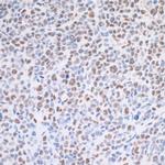 MED1 Antibody in Immunohistochemistry (Paraffin) (IHC (P))