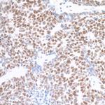 MED1 Antibody in Immunohistochemistry (Paraffin) (IHC (P))