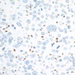 c-Maf Antibody in Immunohistochemistry (Paraffin) (IHC (P))